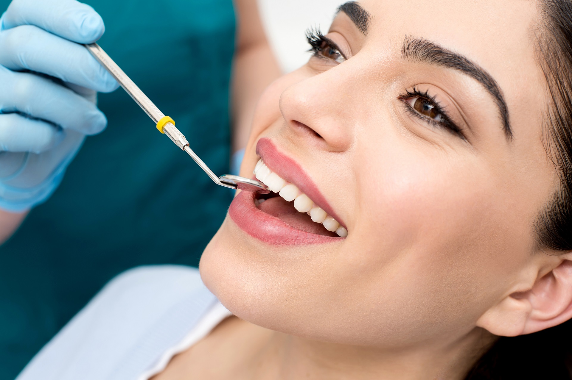 Dental Bonding Services In Rockford